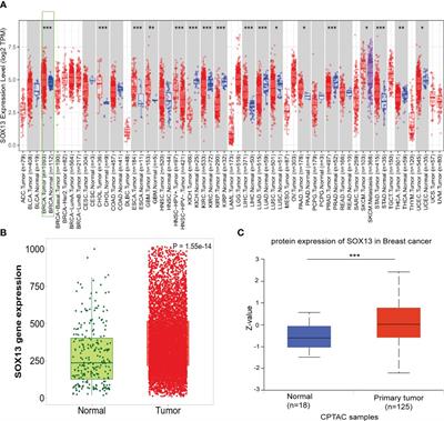 SOX13 is a novel prognostic biomarker and associates with immune infiltration in breast cancer